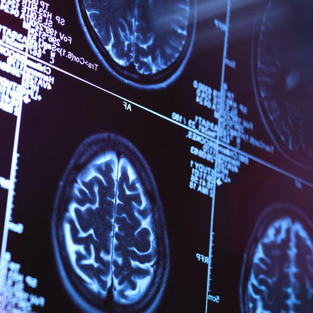 Brain MRI for Neuroscience